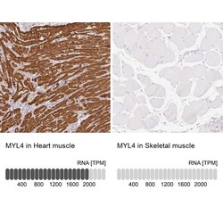 MYL4 Antibody, Novus Biologicals 0.1mL; Unlabeled:Antibodies, Polyclonal